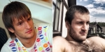 Алексей Самсонов до и после ринопластики