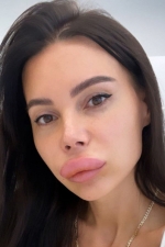 Оксана Самойлова губы