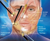 FaceTite обрабатывает три слабых участка на лице