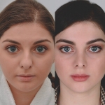 Марина до и после ринопластики