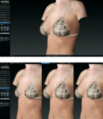 3D-моделировние для пациентов доктора Свиридова